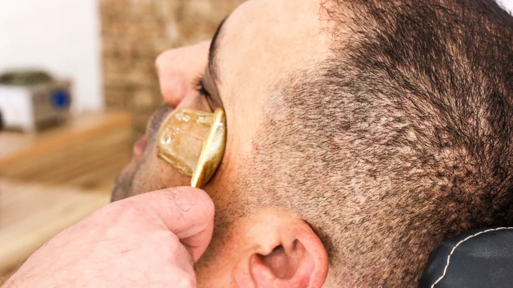 Hair Removal service